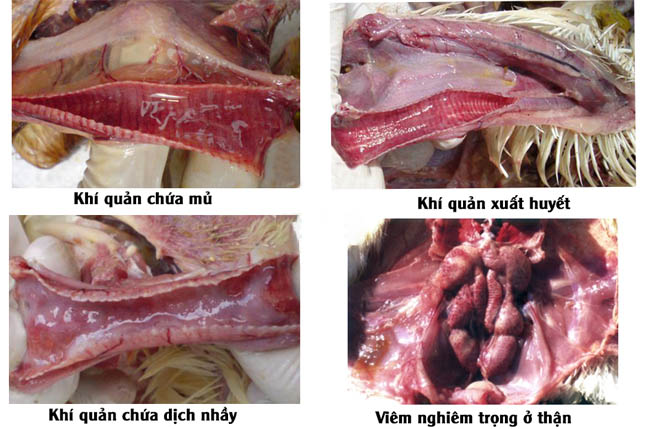 BỆNH VIÊM PHẾ QUẢN TRUYỀN NHIỄM